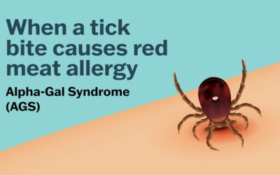 Massachusetts Department of Public Health Designates Alpha-Gal Syndrome a Reportable Condition